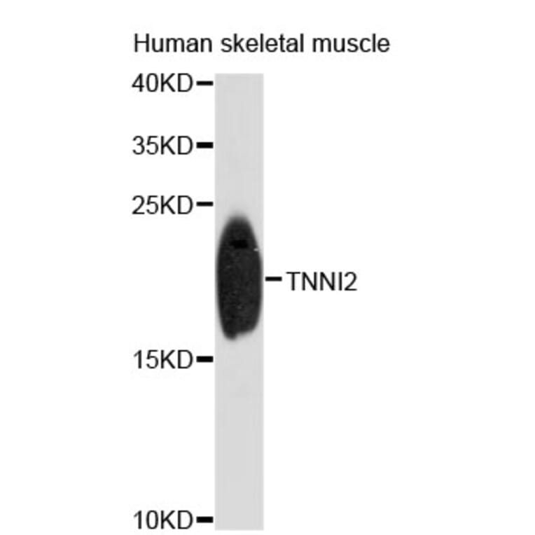 Western Blot - Anti-TNNI2 Antibody (A4162) - Antibodies.com