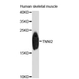 Western Blot - Anti-TNNI2 Antibody (A4162) - Antibodies.com