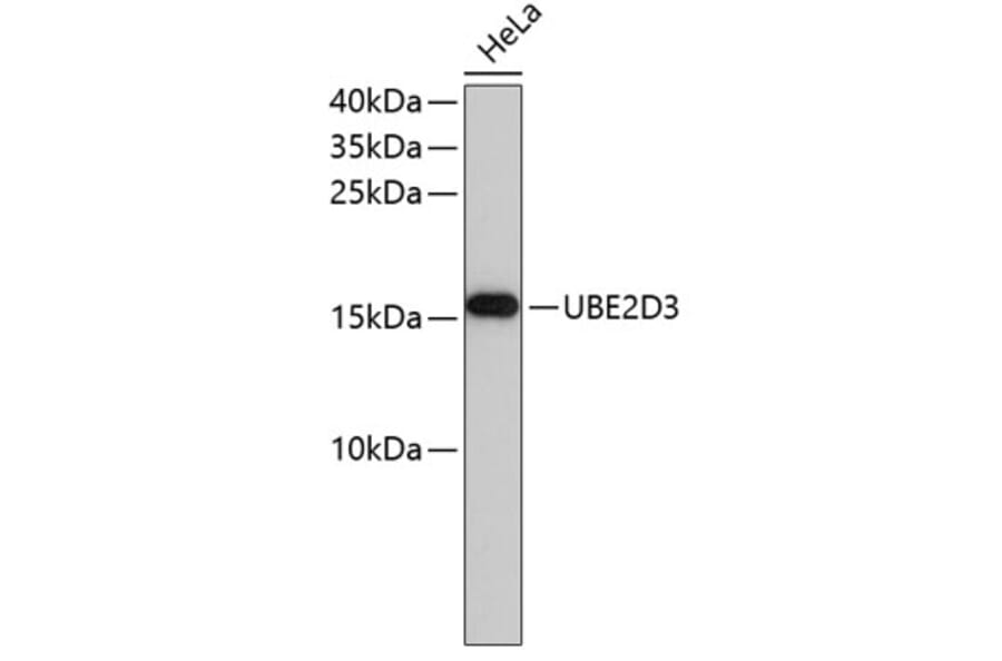 Western Blot - Anti-UBE2D3 Antibody (A4173) - Antibodies.com