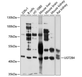 Western Blot - Anti-UGT2B4 Antibody (A9395) - Antibodies.com