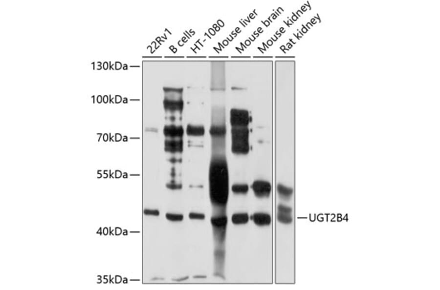 Western Blot - Anti-UGT2B4 Antibody (A9395) - Antibodies.com