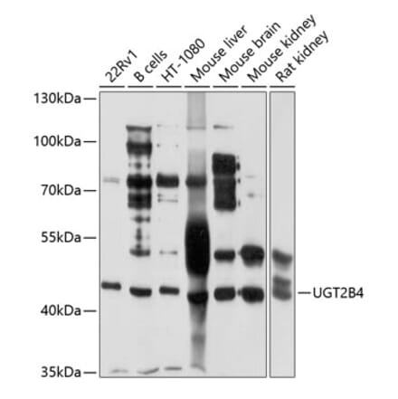 Western Blot - Anti-UGT2B4 Antibody (A9395) - Antibodies.com