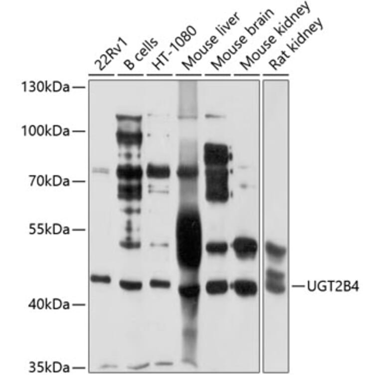 Western Blot - Anti-UGT2B4 Antibody (A9395) - Antibodies.com