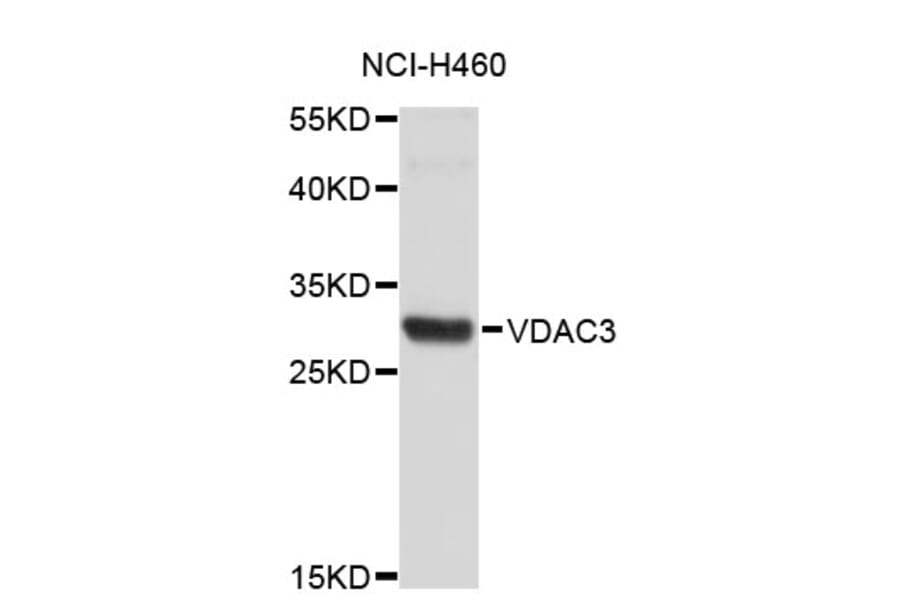 Western Blot - Anti-VDAC3 Antibody (A4183) - Antibodies.com