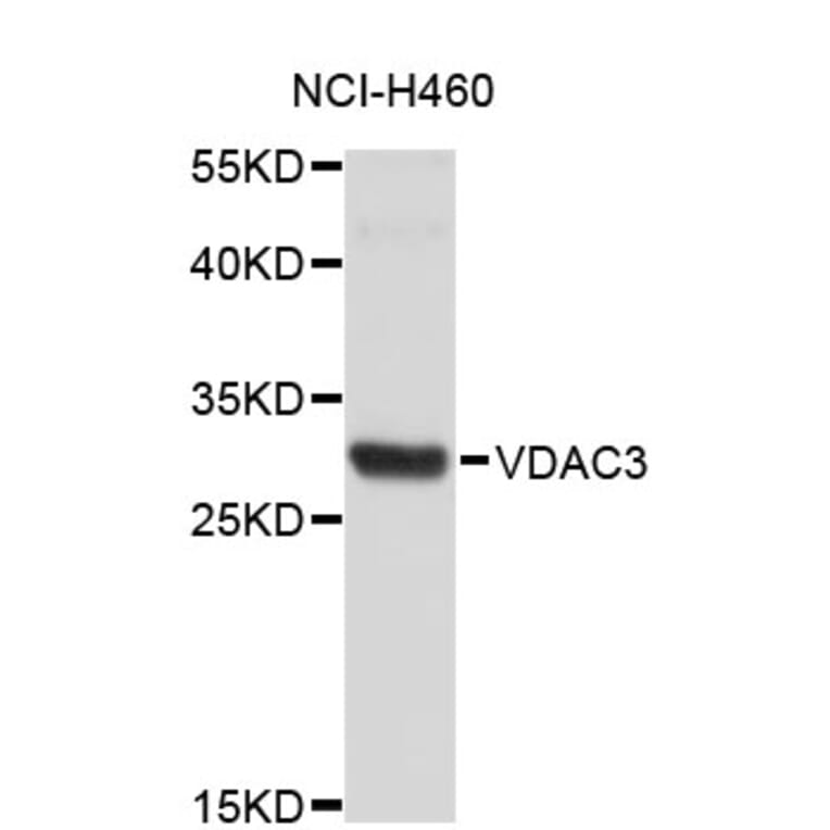 Western Blot - Anti-VDAC3 Antibody (A4183) - Antibodies.com