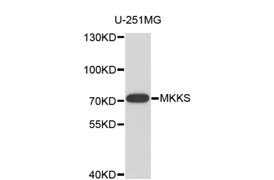 Western Blot - Anti-MKKS Antibody (A4206) - Antibodies.com