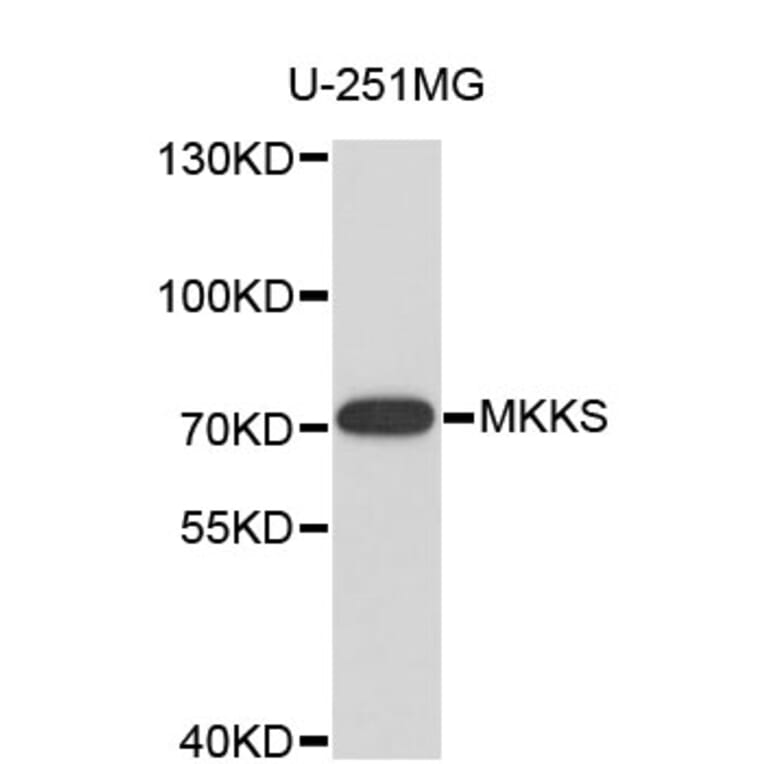 Western Blot - Anti-MKKS Antibody (A4206) - Antibodies.com