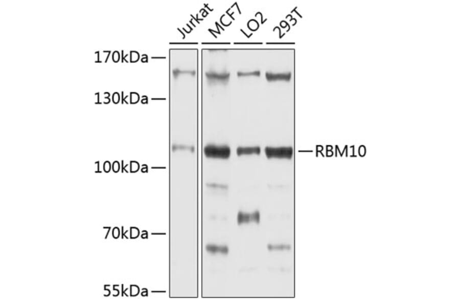 Western Blot - Anti-RBM10/S1-1 Antibody (A9401) - Antibodies.com