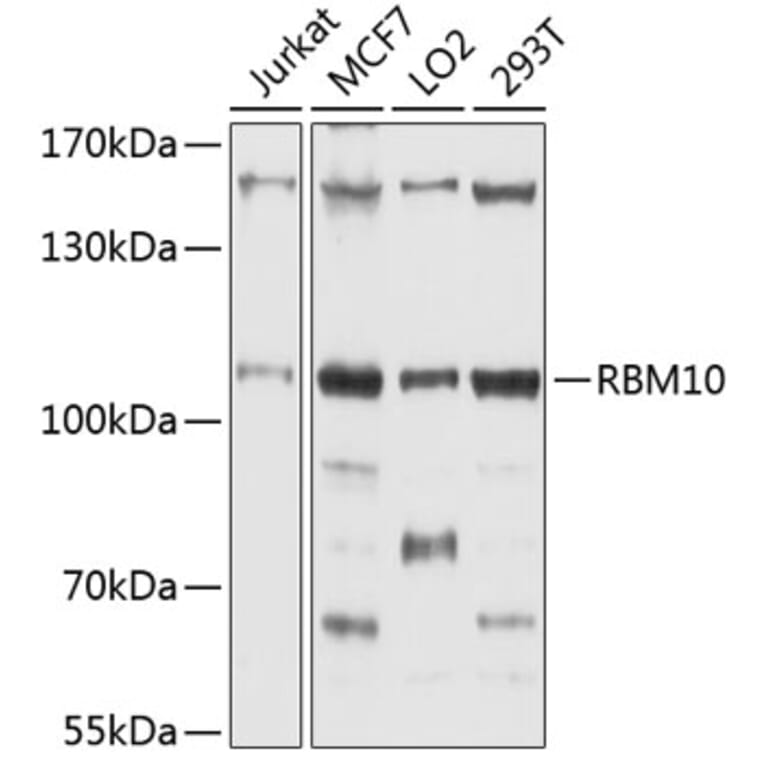 Western Blot - Anti-RBM10/S1-1 Antibody (A9401) - Antibodies.com