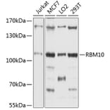 Western Blot - Anti-RBM10/S1-1 Antibody (A9401) - Antibodies.com