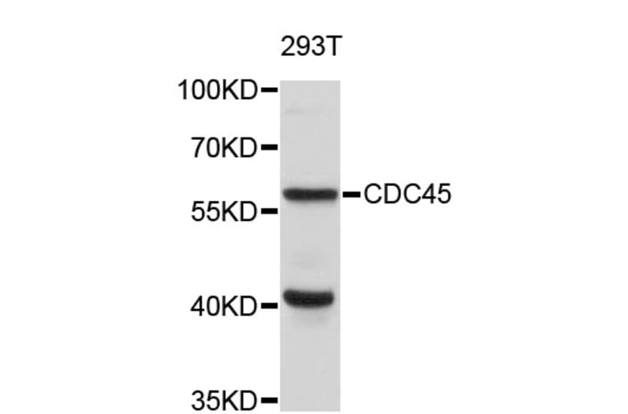 Western Blot - Anti-CDC45 Antibody (A4212) - Antibodies.com