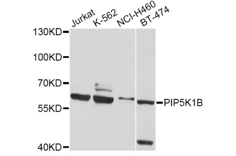 Western Blot - Anti-PIP5K1B Antibody (A4215) - Antibodies.com
