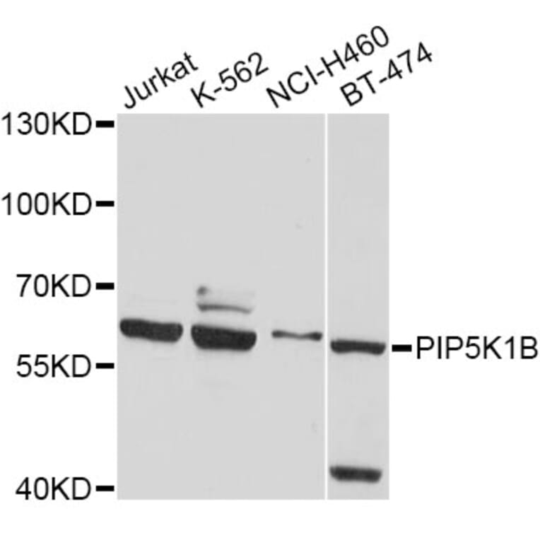Western Blot - Anti-PIP5K1B Antibody (A4215) - Antibodies.com