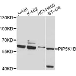 Western Blot - Anti-PIP5K1B Antibody (A4215) - Antibodies.com