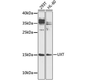 Western Blot - Anti-UXT Antibody (A9405) - Antibodies.com