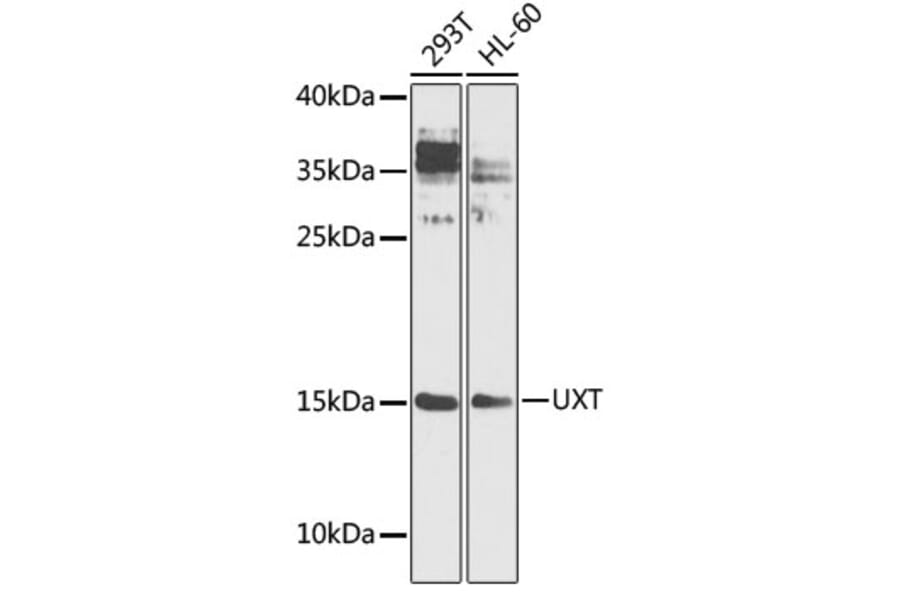 Western Blot - Anti-UXT Antibody (A9405) - Antibodies.com