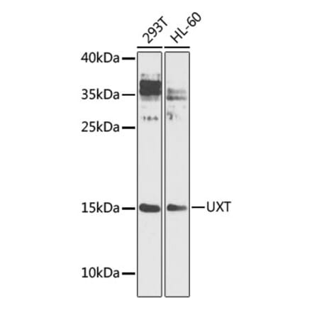 Western Blot - Anti-UXT Antibody (A9405) - Antibodies.com