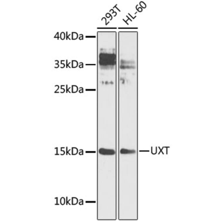Western Blot - Anti-UXT Antibody (A9405) - Antibodies.com