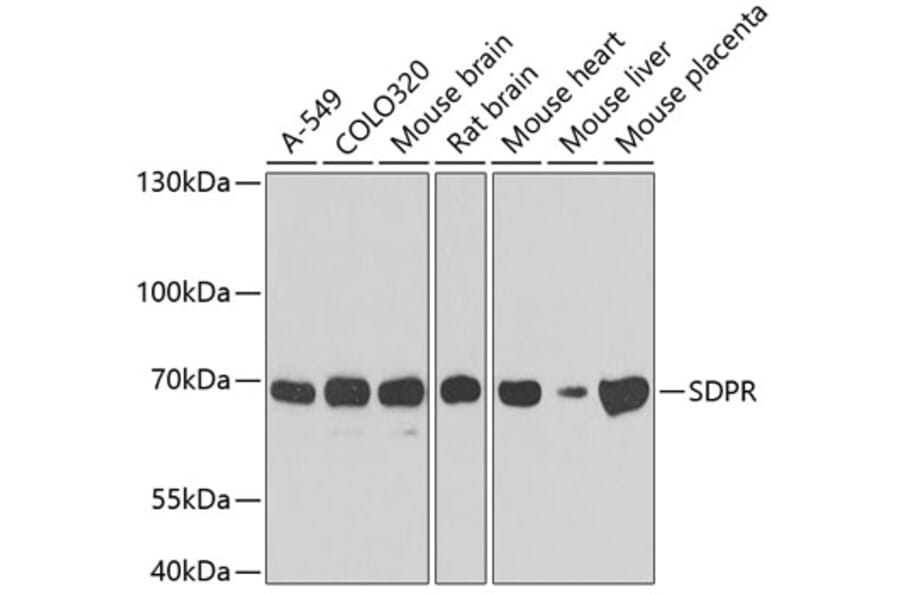 Western Blot - Anti-SDPR Antibody (A4219) - Antibodies.com