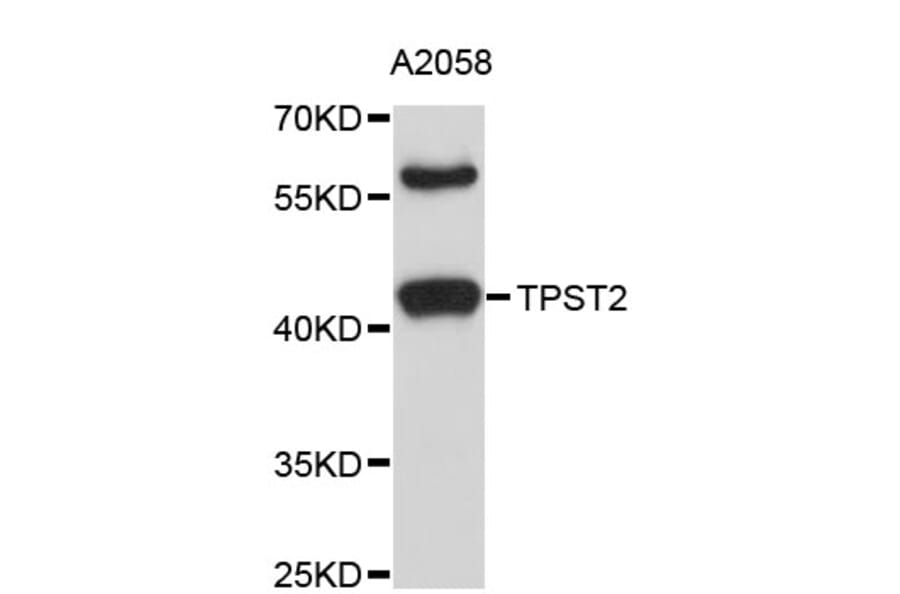 Western Blot - Anti-TPST2 Antibody (A4221) - Antibodies.com