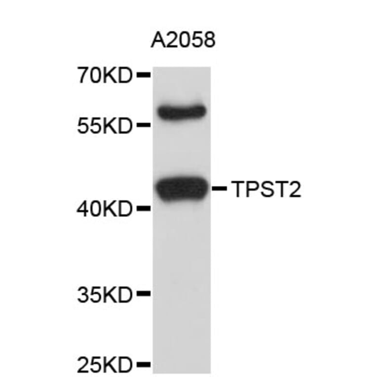 Western Blot - Anti-TPST2 Antibody (A4221) - Antibodies.com