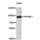 Western Blot - Anti-PPFIBP1 Antibody (A4225) - Antibodies.com