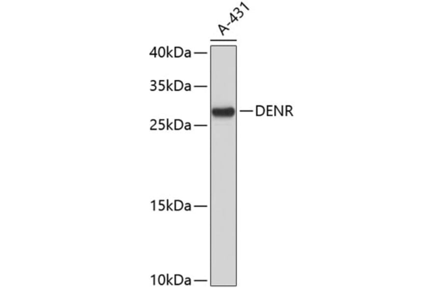 Western Blot - Anti-DENR Antibody (A4233) - Antibodies.com