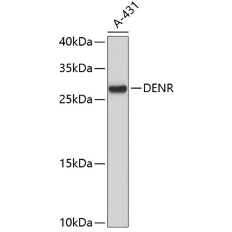 Western Blot - Anti-DENR Antibody (A4233) - Antibodies.com