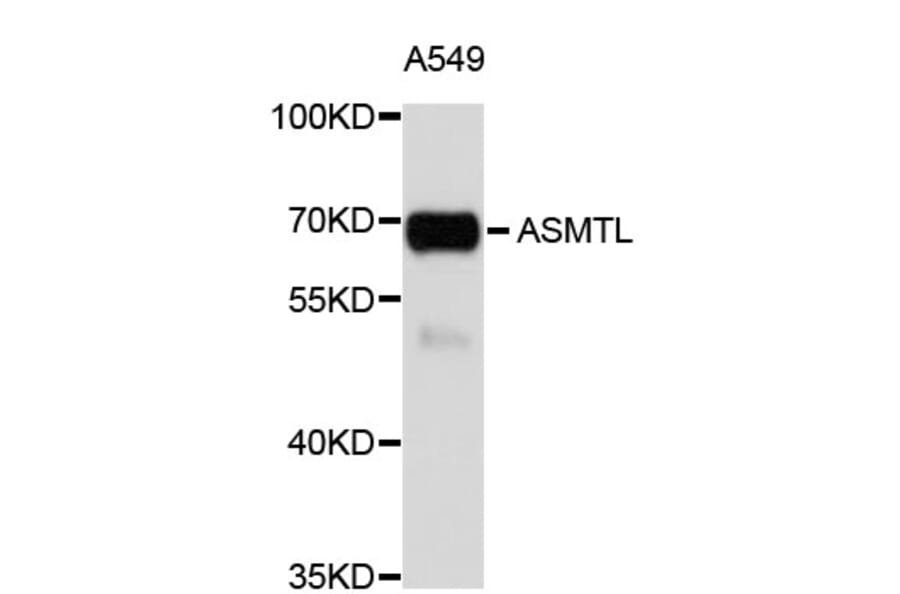 Western Blot - Anti-ASMTL Antibody (A4237) - Antibodies.com