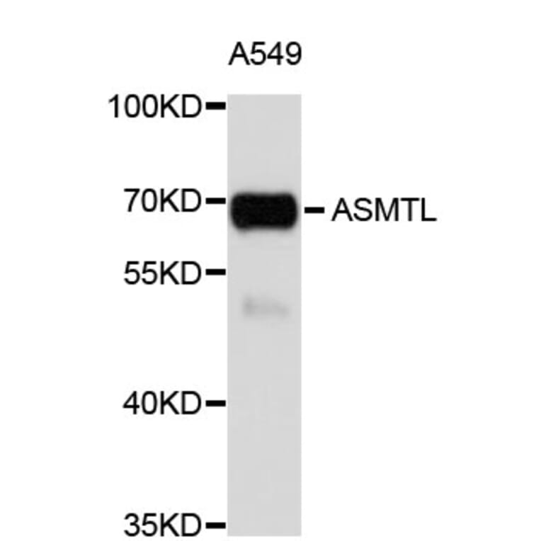 Western Blot - Anti-ASMTL Antibody (A4237) - Antibodies.com