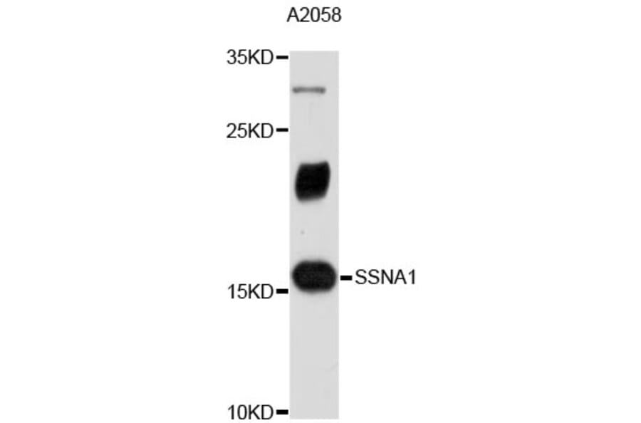 Western Blot - Anti-SSNA1 Antibody (A4239) - Antibodies.com