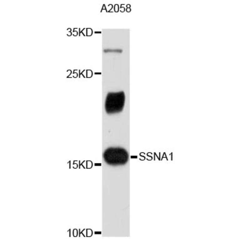 Western Blot - Anti-SSNA1 Antibody (A4239) - Antibodies.com
