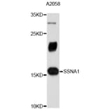 Western Blot - Anti-SSNA1 Antibody (A4239) - Antibodies.com