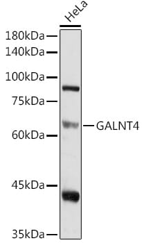 Western blot analysis of extracts of HeLa cells, using Anti-GALNT4 Antibody (A4243).
Secondary antibody: Goat Anti-Rabbit IgG (H+L) (HRP) (AS014) at 1:10,000 dilution.
Lysates / proteins: 25µg per lane.
Blocking buffer: 3% non-fat dry milk in TBST.