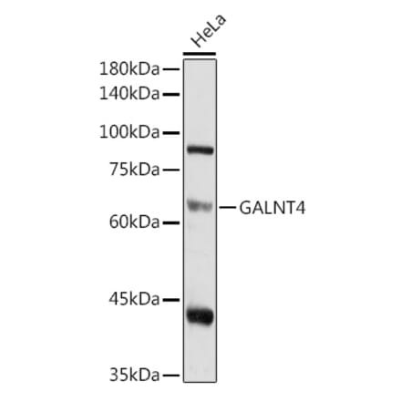Western Blot - Anti-GALNT4 Antibody (A9415) - Antibodies.com