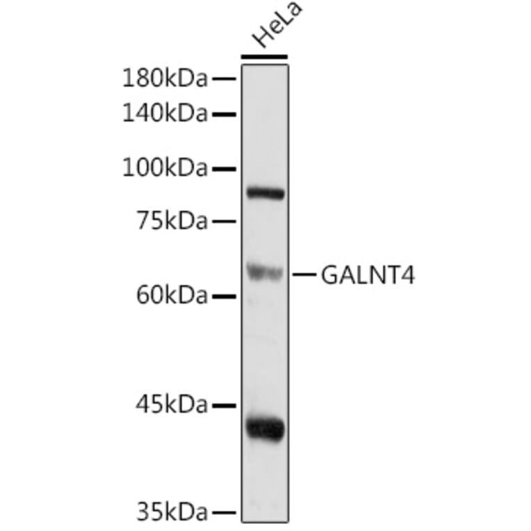 Western Blot - Anti-GALNT4 Antibody (A9415) - Antibodies.com