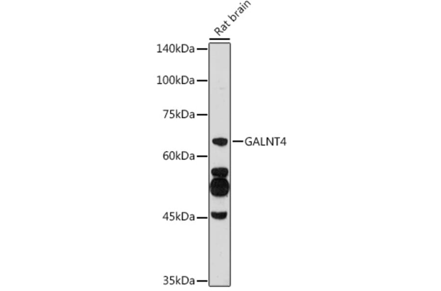 Western Blot - Anti-GALNT4 Antibody (A9415) - Antibodies.com