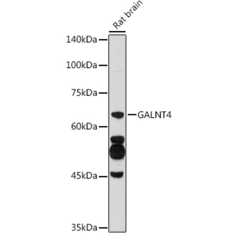 Western Blot - Anti-GALNT4 Antibody (A9415) - Antibodies.com