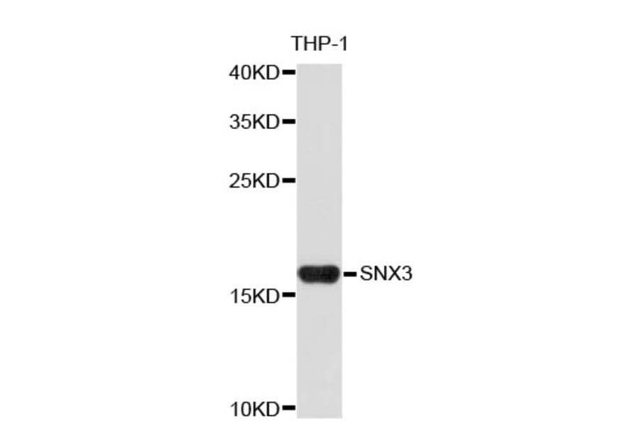 Western Blot - Anti-SNX3 Antibody (A4246) - Antibodies.com