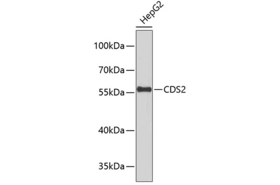 Western Blot - Anti-CDS2 Antibody (A9418) - Antibodies.com
