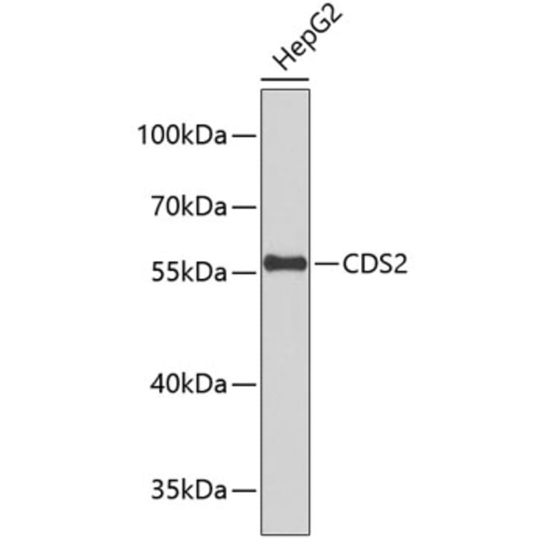 Western Blot - Anti-CDS2 Antibody (A9418) - Antibodies.com