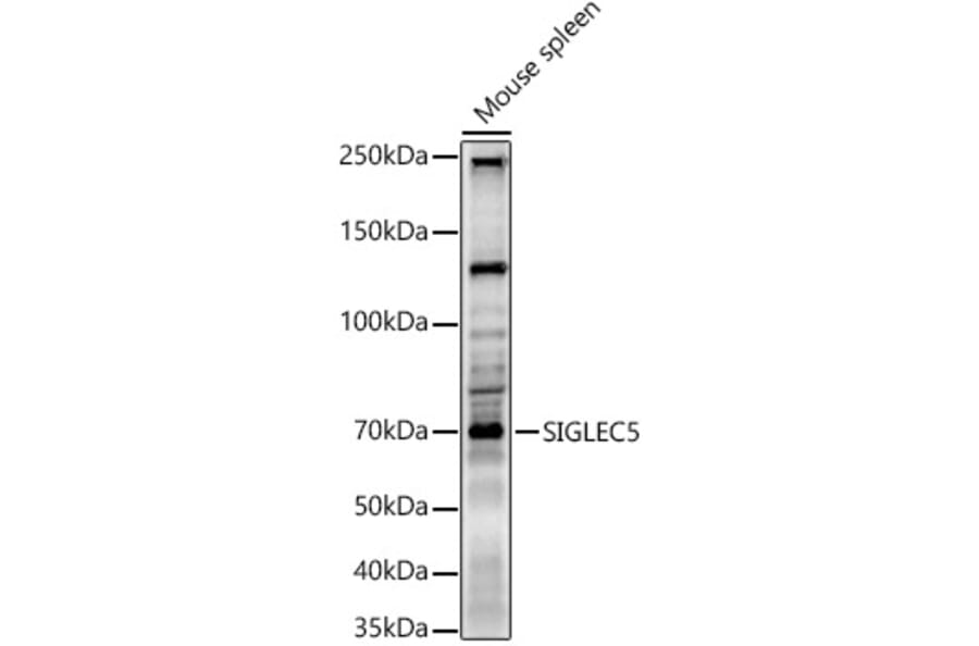 Western Blot - Anti-SIGLEC5 Antibody (A9419) - Antibodies.com