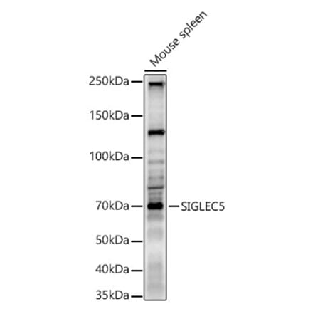 Western Blot - Anti-SIGLEC5 Antibody (A9419) - Antibodies.com