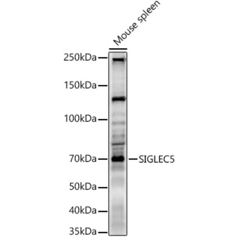 Western Blot - Anti-SIGLEC5 Antibody (A9419) - Antibodies.com