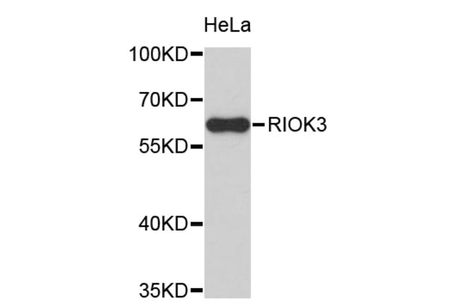 Western Blot - Anti-RIOK3 Antibody (A4251) - Antibodies.com