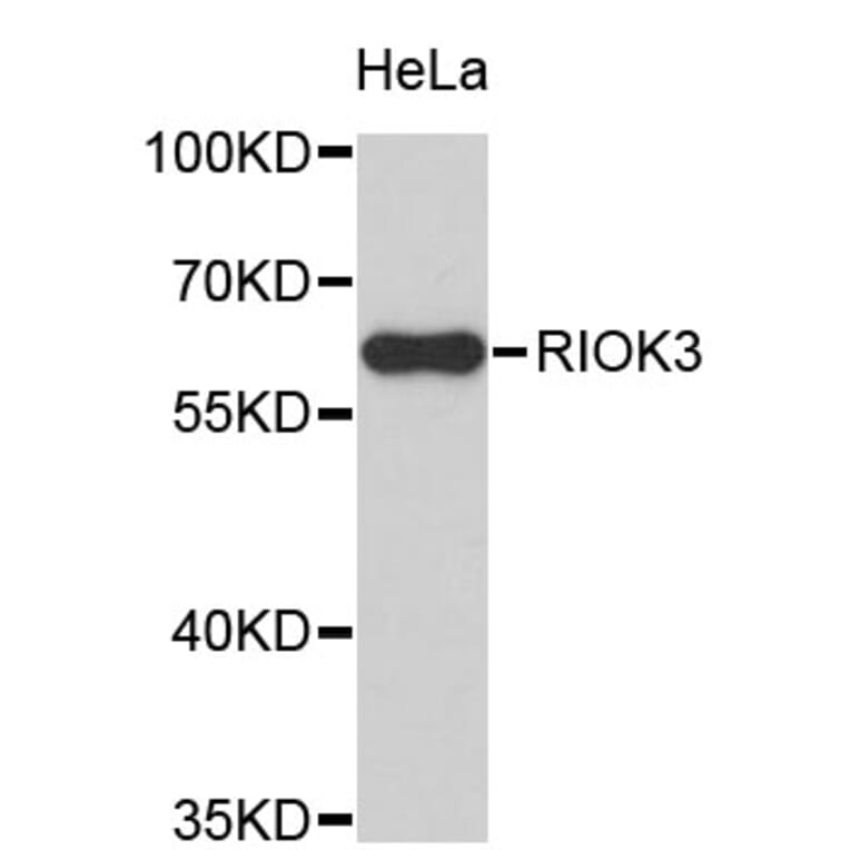 Western Blot - Anti-RIOK3 Antibody (A4251) - Antibodies.com
