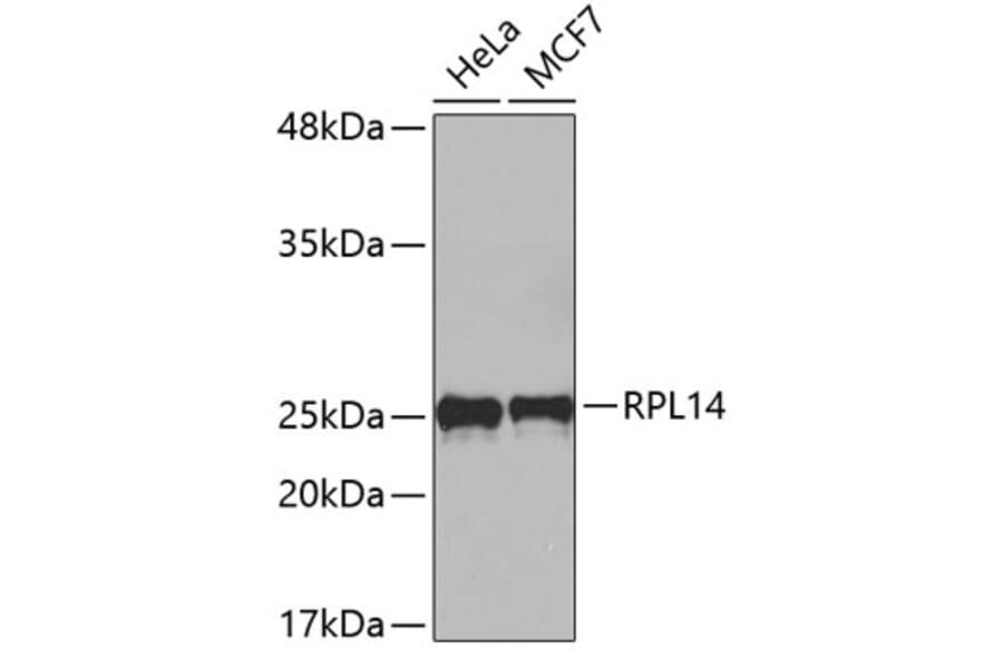 Western Blot - Anti-RPL14 Antibody (A4265) - Antibodies.com