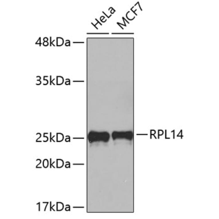Western Blot - Anti-RPL14 Antibody (A4265) - Antibodies.com