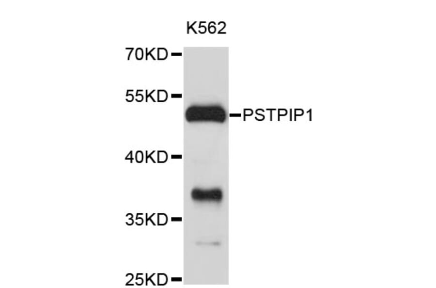 Western Blot - Anti-PSTPIP1 Antibody (A4266) - Antibodies.com