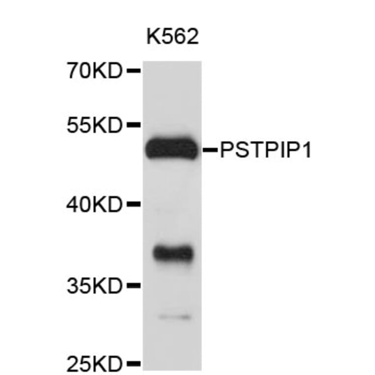 Western Blot - Anti-PSTPIP1 Antibody (A4266) - Antibodies.com